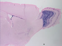 成体脳における神経新生をサポートする微小環境に関する研究