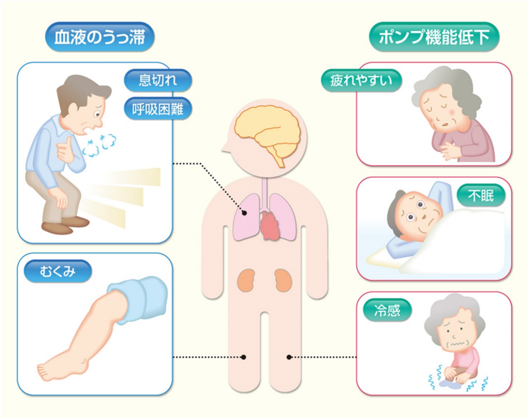 心不全とは?