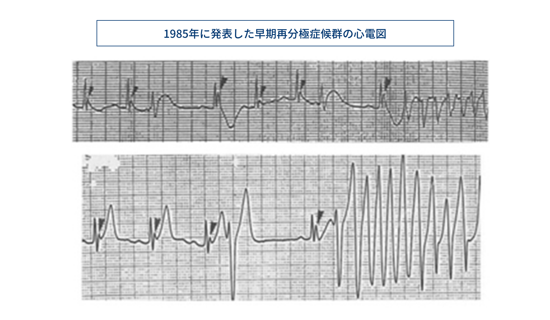 研究テーマ – 不整脈研究グループ ｜ 新潟大学大学院 医歯学総合