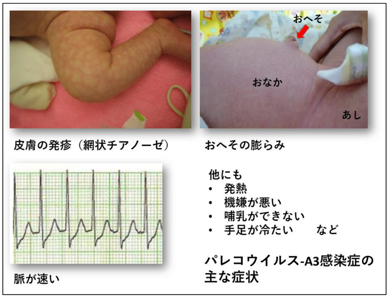 [最も共有された！ √] チアノーゼ 症状 画像 279593チアノーゼ 症状 画像 michaelbelljp