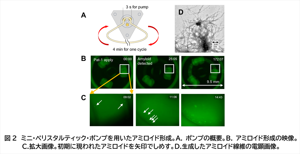ペリスタルティック・ポンプと蛍光顕微鏡によりアミロイド発生をリアルタイム観察 −過飽和の解消が引き起こす溶質から結晶相への相転移−