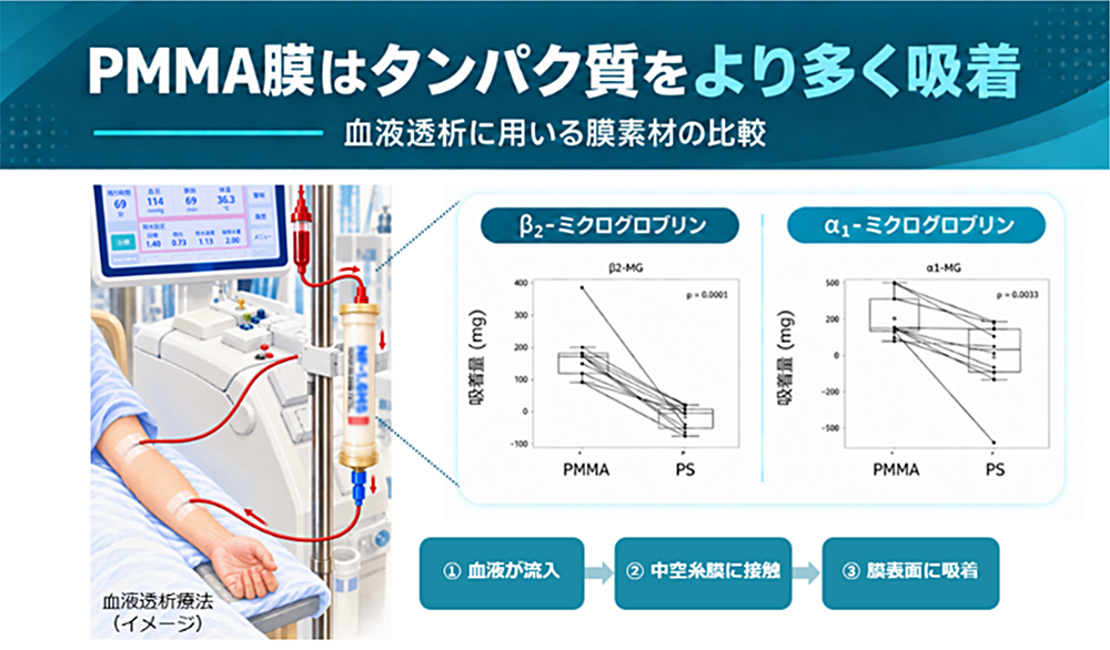 PMMA透析膜によるタンパク質の吸着特性を解明 − 透析で除去しにくい物質への新たな治療戦略に期待 −