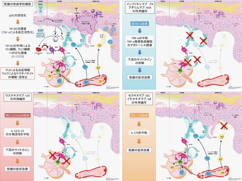乾癬の免疫学的病態と各生物学的製剤の作用点