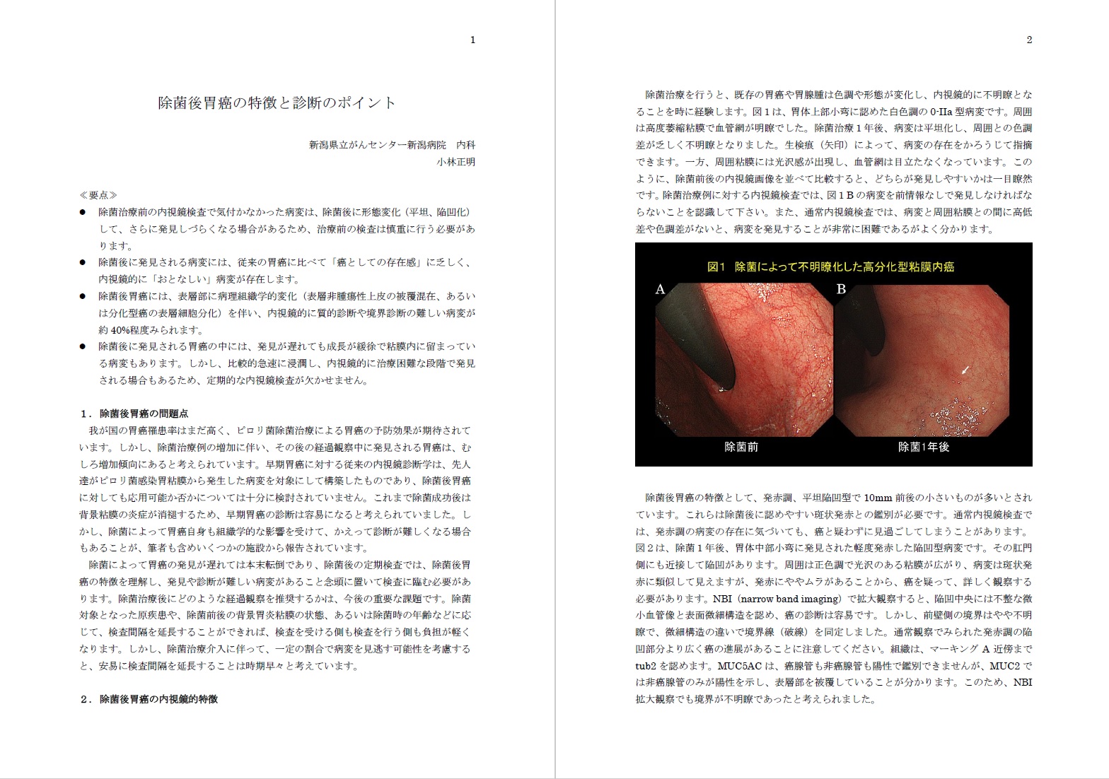 除菌後胃癌の特徴と診断のポイント - 新潟大学大学院医歯学総合研究科