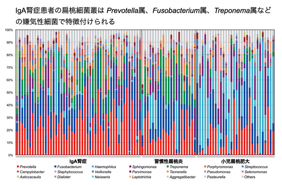 IgA腎症患者の扁桃細菌叢は嫌気性細菌で特徴付けられる