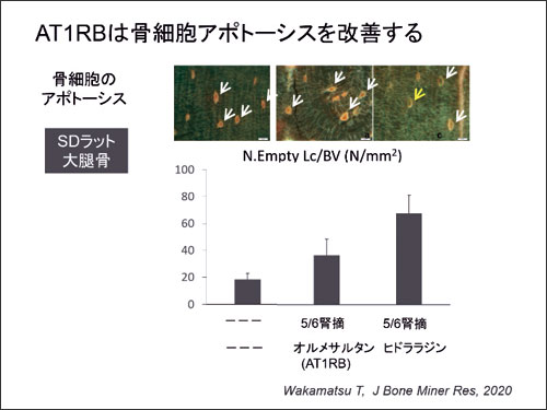 AT1RBは骨細胞アポトーシスを改善する