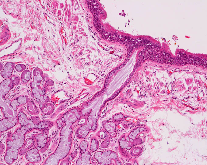 病理標本 気管支 正常 新潟大学医学部臨床病理学分野