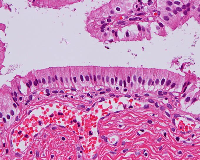 病理標本 胆嚢管 Cystic Duct 正常 新潟大学医学部臨床病理学分野