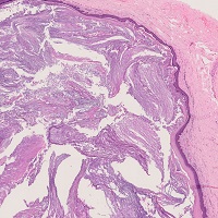病理標本：皮膚|新潟大学医学部臨床病理学分野
