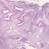 病理標本 女性生殖器２ 新潟大学医学部臨床病理学分野