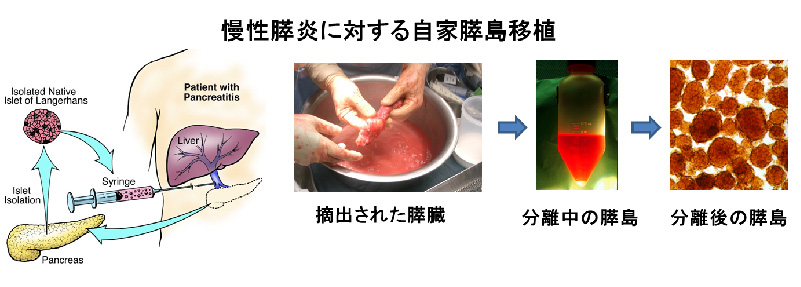 研究活動のご紹介 | 新潟大学大学院小児外科学教室 研究活動のご紹介 | 新潟大学大学院小児外科学教室